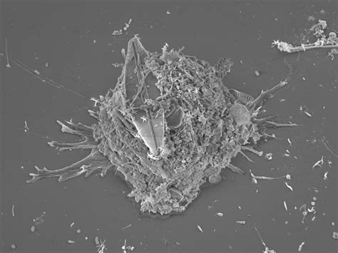  Leptomyxa!  A Microscopic Masterpiece Weaving Invisible Trails